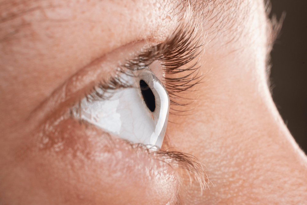 Can Keratoconus Make You Blind?